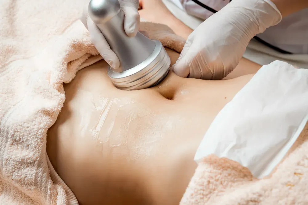 cavitation liposuction treatment