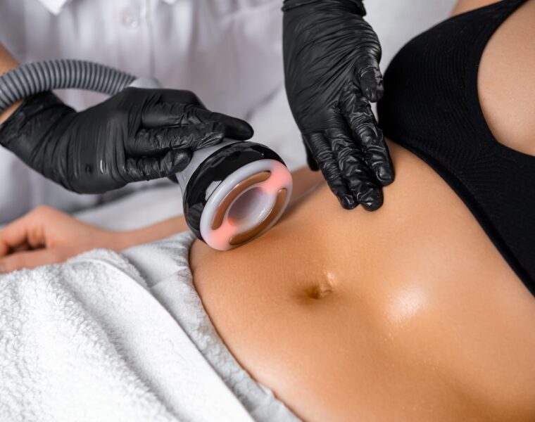 does cavitation liposuction deliver results facts and figures