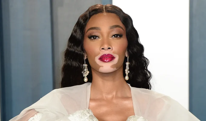 what is Winnie Harlow known for