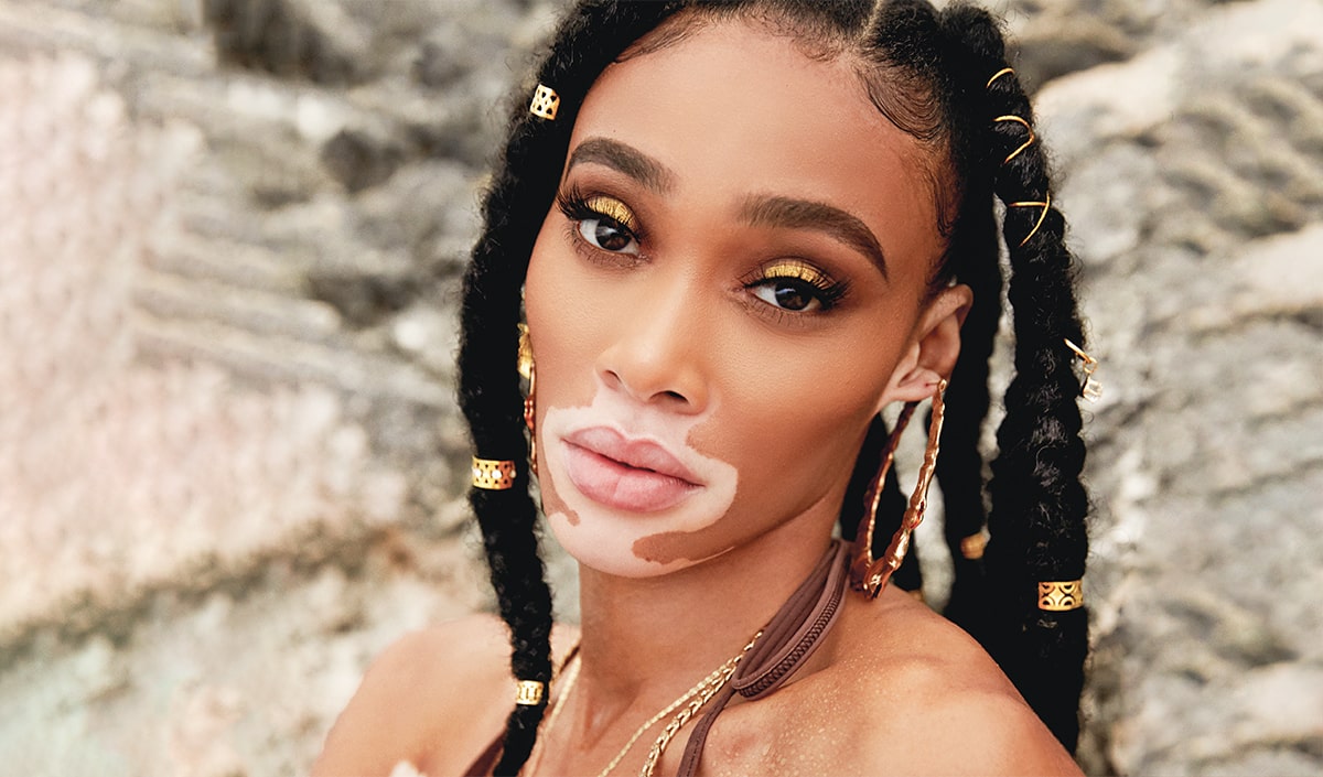 Winnie Harlow